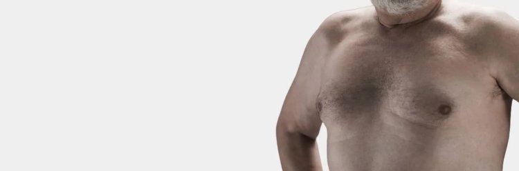 Exploring Different Techniques Used For Gynecomastia Surgery