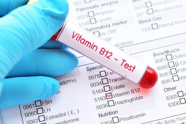 Vitamin B12 Test: Importance, Procedure, Cost & Benefits