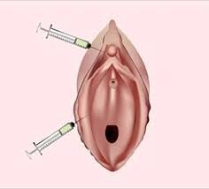 The O-Shot Injection: What Is It and How Can It Benefit You?