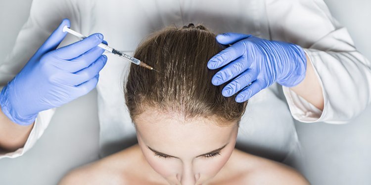 PRP Hair Treatment Dubai: Is It the Solution for Your Hair Loss Problems?