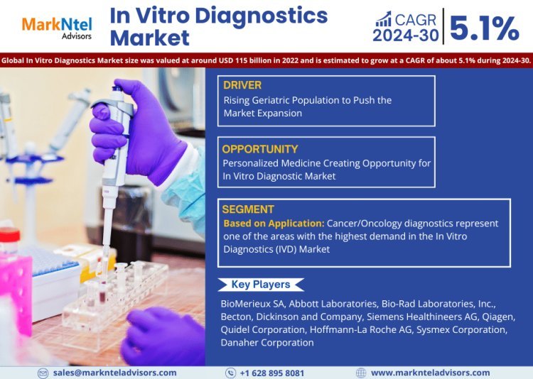 In Vitro Diagnostics Market Dynamics – Driver, Challenge, Segment & Competition FY2030