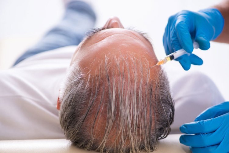 How Effective Are Non-Surgical Hair Restoration Methods Today?