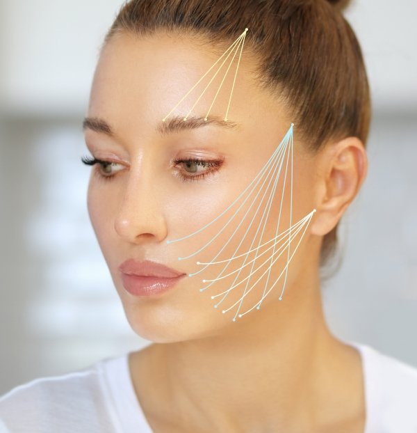 What Makes Thread Lift an Ideal Anti-Aging Treatment?